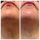 ✨ LumiLift Pro Vaidosa Demais™