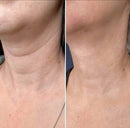 ✨ LumiLift Pro Vaidosa Demais™