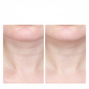 Massageador De Pescoço e Rosto LED Vibração Fototerapia Para Rejuvenescer Firmeza Anti-Rugas