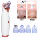 Removedor Cravos e Espinhas Extrator de Cravos Sucção a Vácuo Aparelho Recarregável Sugador Remove Acne
